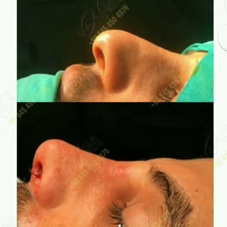 Excellent Experiences by Max Health

Group

maxaesthetics.net

maxhairtrans.com

+90 545 450 4976

+