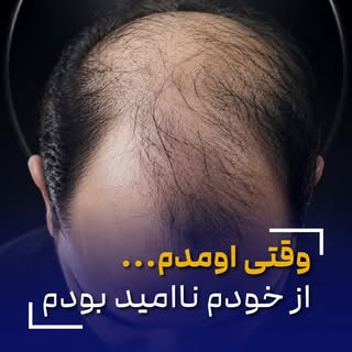 ⁨	‌‌‌
در ناامیدی بسی امید است 👌

🌟امیدتان را که از دست بدهید،
گویی همه‌چیز را از دست داده‌اید.
الب