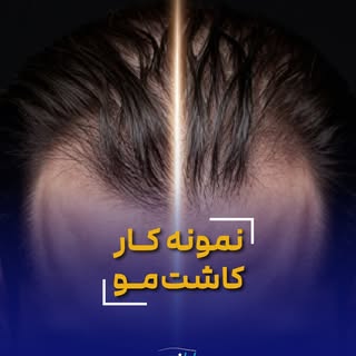 از حسِ خالی بودن، تا داشتن موهای پرپشت… 💭

بیشتر مراجعین ما قبل از اینکه پیش ما بیایند، روزها و ماه