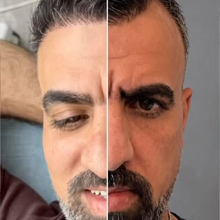 کاشت مو در تهران؛ از بغداد تا ایران نوین ✈️🇮🇶🇮🇷

 مراجعه‌کننده عراقی عزیز از بغداد به تهران سفر 