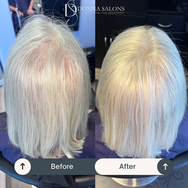 From thinning to thriving ✨ Check out this gorgeous transformation at Donna Salons in Naples, FL! A 
