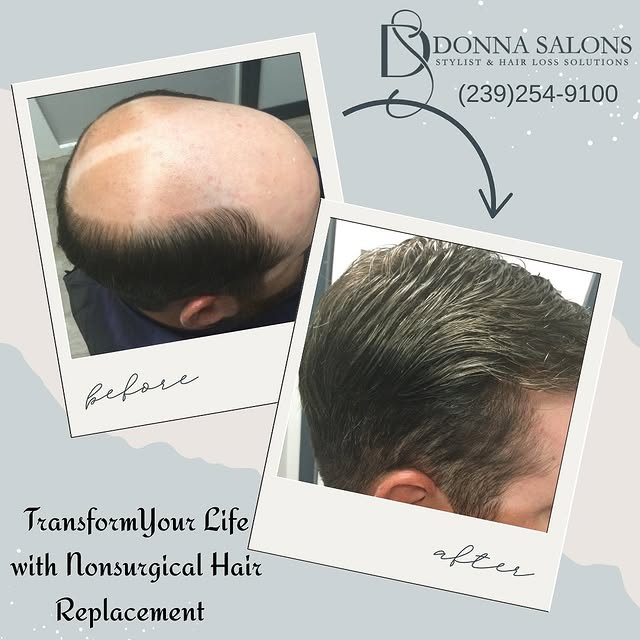 ✨ Transformation Tuesday ✨
Check out this amazing before & after from a recent non-surgical hair rep