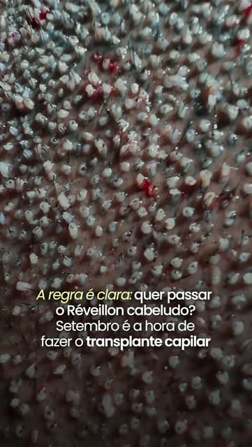 O fim do ano tá chegando, hein? Não perde tempo. 👀 

Agende a sua avaliação em uma de nossas unidad