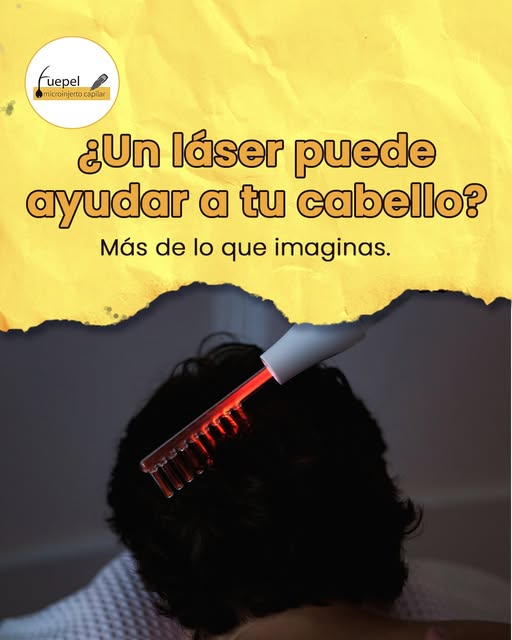 El láser capilar de baja intensidad puede formar parte de un tratamiento para fortalecer el cabello 