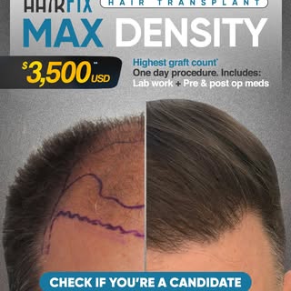 Your transformation starts today! 😎

Restore your hair and confidence with the Hairfix Max Density 