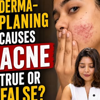 Does dermaplaning cause acne? True or False? 
While dermaplaning is generally safe, doing it incorre