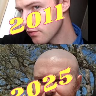 The ONE video you should watch about Scalp Micropigmentation... See the full video in bio.

Want a f