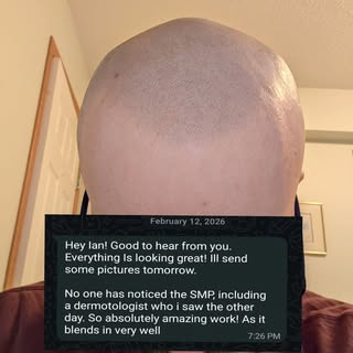 From Toronto ✈️ Houston. When you’re looking for the most natural Scalp Micropigmentation out there,