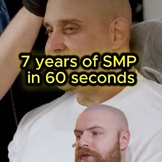 Jared, from California, was willing to go anywhere in the United States for the most natural SMP. He