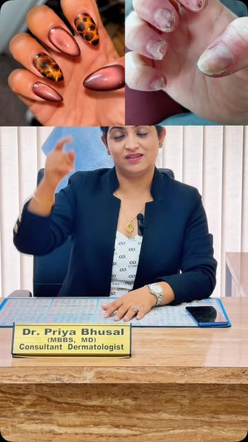 Acrylic and Gel nail.. How safe is it to do on a regular basis. Let’s learn from your dermatologist 