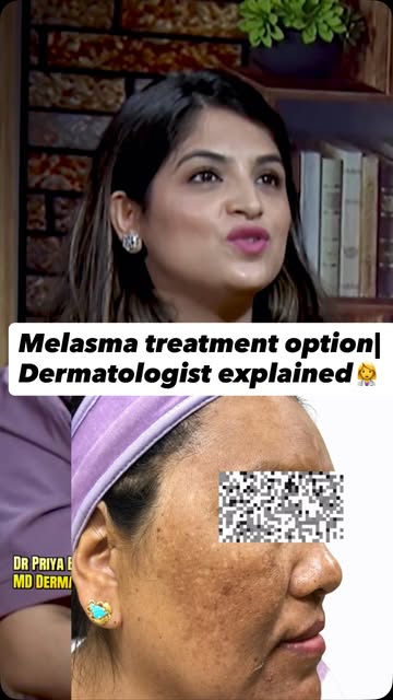 👩‍⚕️Melasma अर्थात् छालामा देखिने खैरो वा गाढा खैरो दाग (Chaya Poto) को उपचार गर्दा एउटै क्रीम वा ए