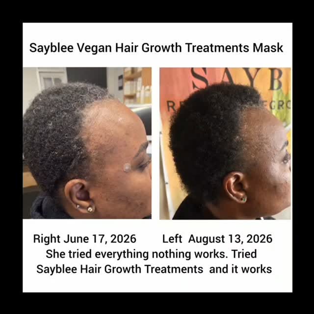 #SaybleeSays wow!!! Look at this one. See our client results, and review. 
.
.
Only time will tell a