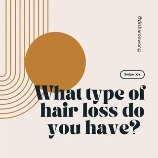 If you’ve started losing your hair and you’re not quite sure what’s going on, you’ve come to the rig