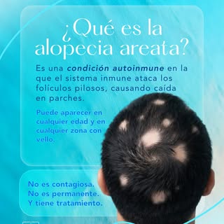 ¿Notaste zonas sin cabello en forma de parches? Puede ser alopecia areata.

Es una condición autoinm