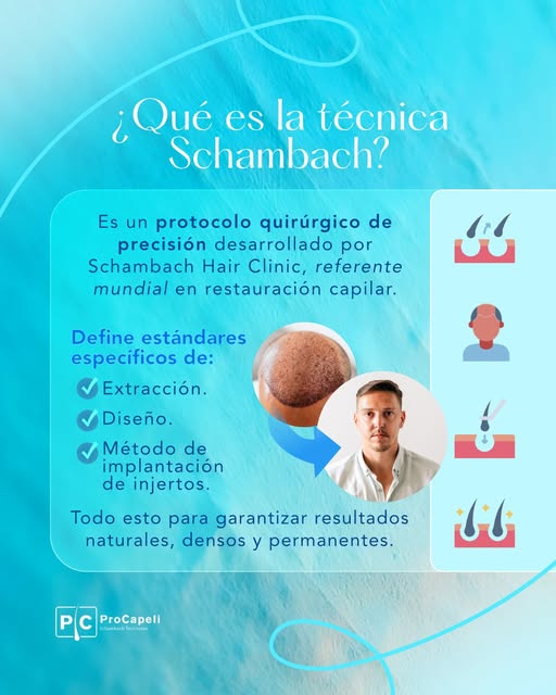 No todos los trasplantes capilares son iguales. La diferencia está en la técnica y en quién la aplic