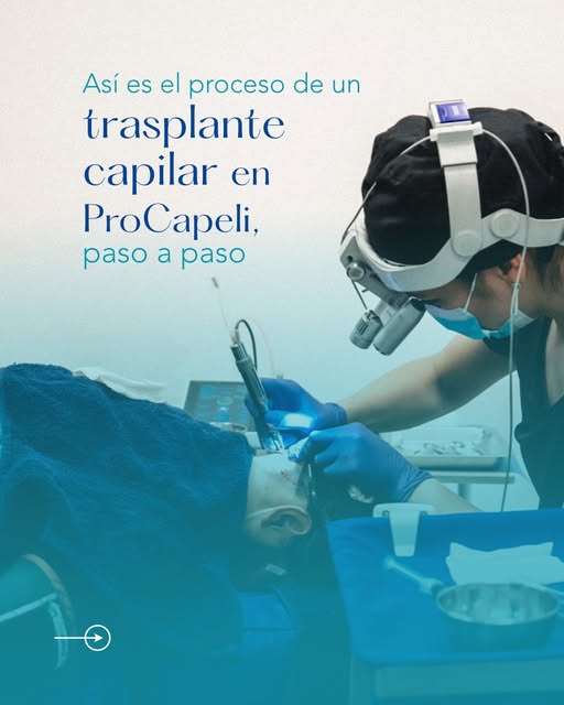¿Cómo es el proceso de un trasplante capilar en ProCapeli? Más sencillo de lo que imaginas.

Desde l