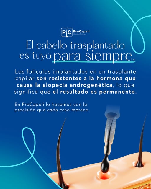 El cabello trasplantado no vuelve a caer. ¿Por qué?

Porque los folículos que se implantan en un tra