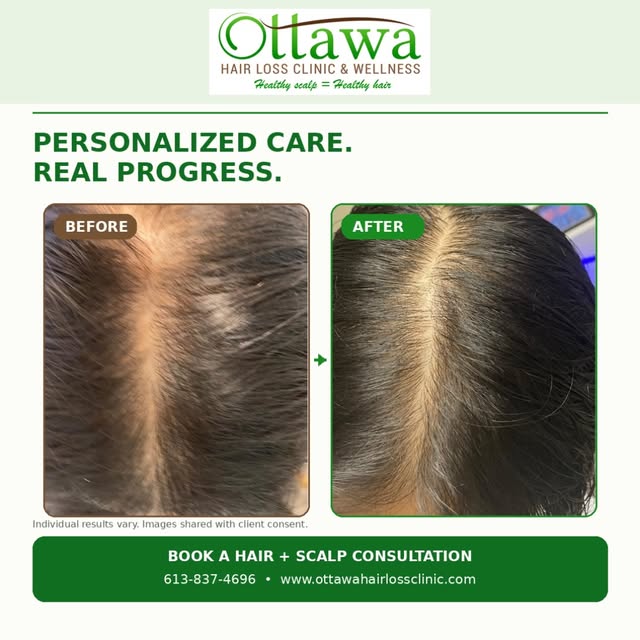 Every hair journey is personal and the body matters too.

This client’s progress followed a thoughtf