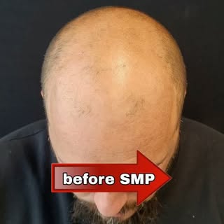 💥 SAME MAN... DIFFERENT DAY 💥
THIS CAN BE 🔥YOU🔥.

We specialize in SMP since 2014.✅️
Free consul
