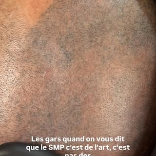 Arrête d’aller chez n’importe qui 😡😡😡

#smp #micropigmentation #alger