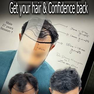When it comes to addressing hair thinning, you shouldn't just paper over the cracks with temporary f