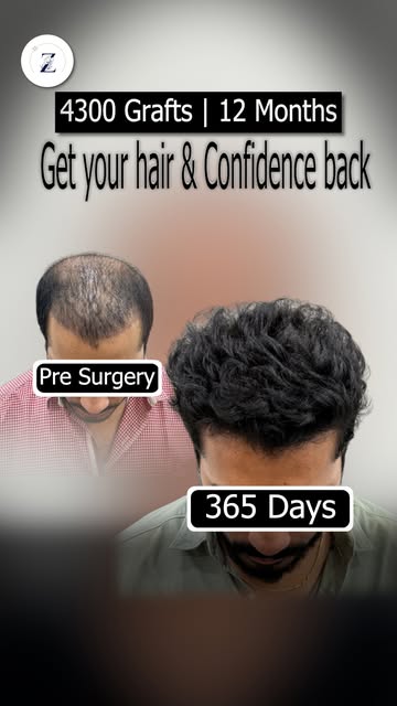 When hair loss takes a toll on your self-image, taking action to turn back the clock is the ultimate