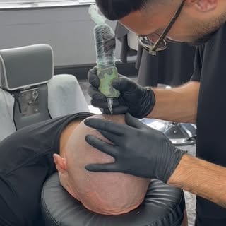 Precision in every dot. Crafting hairlines, restoring confidence. 🪄 #SMPCheltenham #HairlineRestora