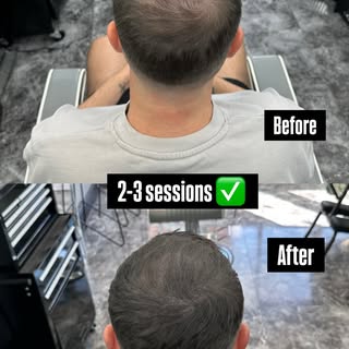 2/3 sessions complete on this client. Looking forward to seeing the final results! #smp #smpcheltenh