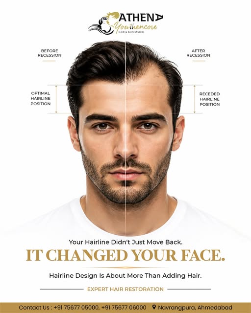 Your hairline didn’t just move back.
IT CHANGED YOUR FACE

📍Book your Exclusive consultation today.