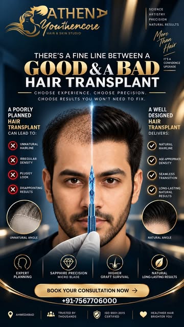 THERE’S A FINE LINE BETWEEN A GOOD & BAD HAIR TRANSPLANT.

A hair transplant is not simply about add