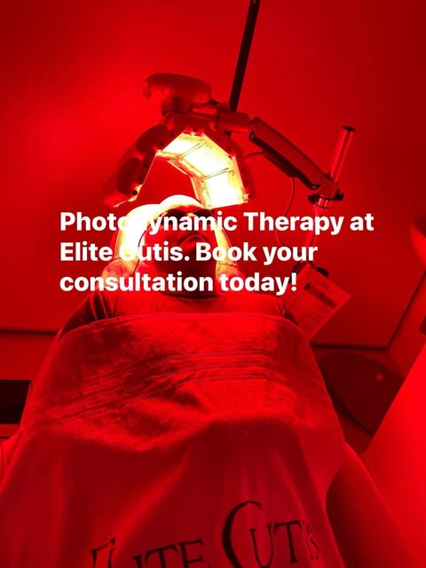 “Why wait in uncertainty? Choose clarity with Photodynamic Therapy at Elite Cutis! 🌟 #EliteCutis”
