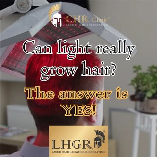 Laser Hair Growth Regeneration (LHGR) is a clinically proven, non-invasive method to stimulate hair 
