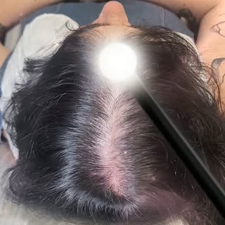 Women experience hair loss too—and you don't have to keep trying to hide it. ✨

Scalp Micropigmentat