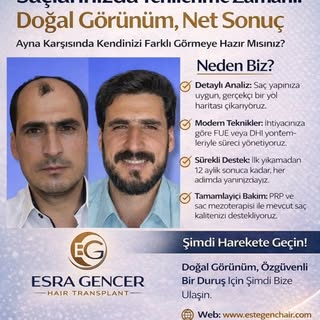 Hayalinizdeki Saçlar.. 
​Esra Gençer Hairtransplant olarak, sürecinizi sizin için şeffaf ve anlaşılı