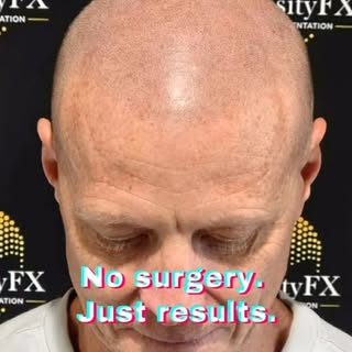 The hairline changes everything.

These three transformations show how the right hairline can enhanc