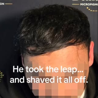 Perth men are you ready to take the Leap 👊

He took the leap… and shaved it all off.

With an edge-