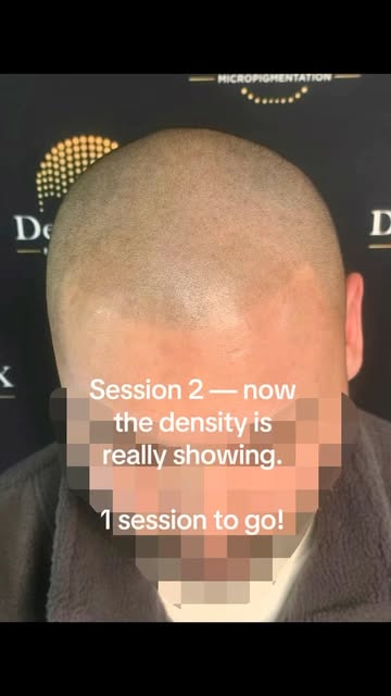2 sessions down. 1 to go for this Perth Client 🔥

The transformation is really starting to come tog