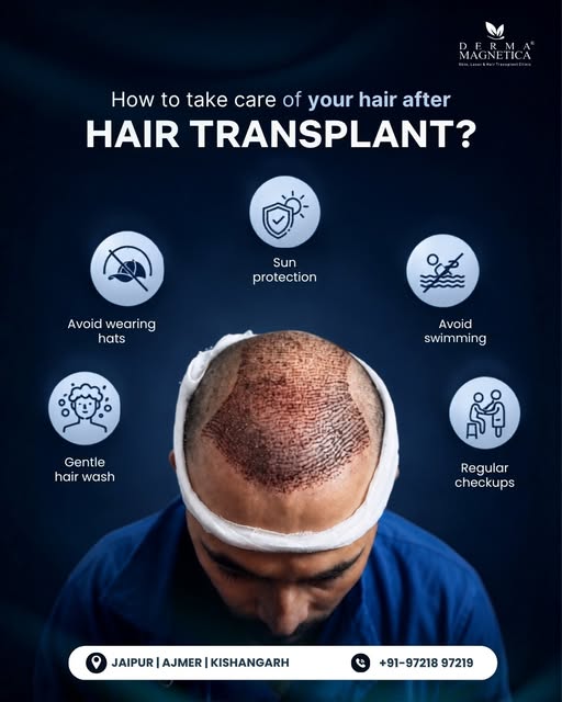 Hair transplant ke baad care bhi utni hi important hai! 🧑‍⚕️✨

A successful hair transplant is just