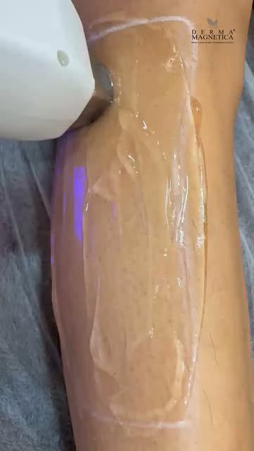 Tired of constant shaving, waxing, and unwanted hair?

Experience smoother-looking, hair-free skin w
