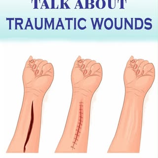 🚑✨ Join Dr. Harshvardhan at Divine Skin, Hair & Plastic Surgical Centre as he explains traumatic wo