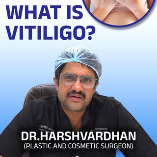 Discover the truth about vitiligo and how Autologous Melanocyte Transfer can restore your natural sk