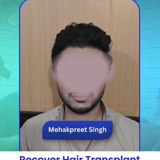 Real Patient. Real Experience. Real Confidence.

Choosing a hair transplant is a big decision-and he