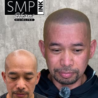 Not everybody is concerned with their hair loss, but for those who are looking for a way to take a l