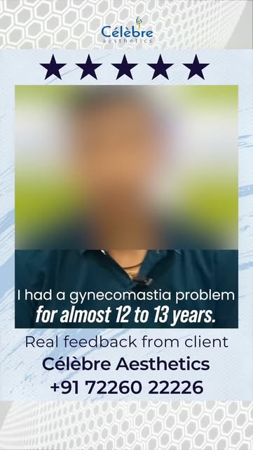 For years, gynecomastia affected his confidence… but the right treatment changed everything. ✨

Afte