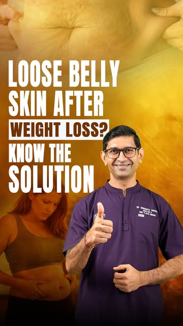 Losing weight is a big achievement, but sometimes loose tummy skin can still remain.

After signific