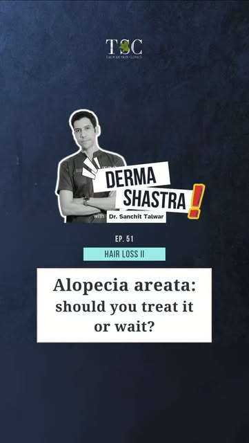 Alopecia areata can appear suddenly as smooth, round patches of hair loss. But do you need to treat 