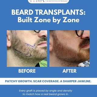 Full, natural beard growth doesn't happen by accident.

Facial hair grows differently than scalp hai