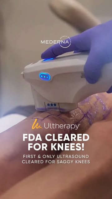 NEW FDA-CLEARED INDICATION ✨ ULTHERAPY PRIME® FOR KNEES

Ultherapy PRIME® is now FDA-cleared to impr