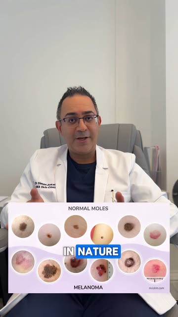 MOLE REMOVAL, WITH DERMATOLOGY AT THE CORE

A mole you’re concerned about deserves more than a cosme