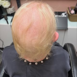 ✨ Before & After | Human Hair Wig Transformation ✨

Hair loss can affect anyone, and every journey i